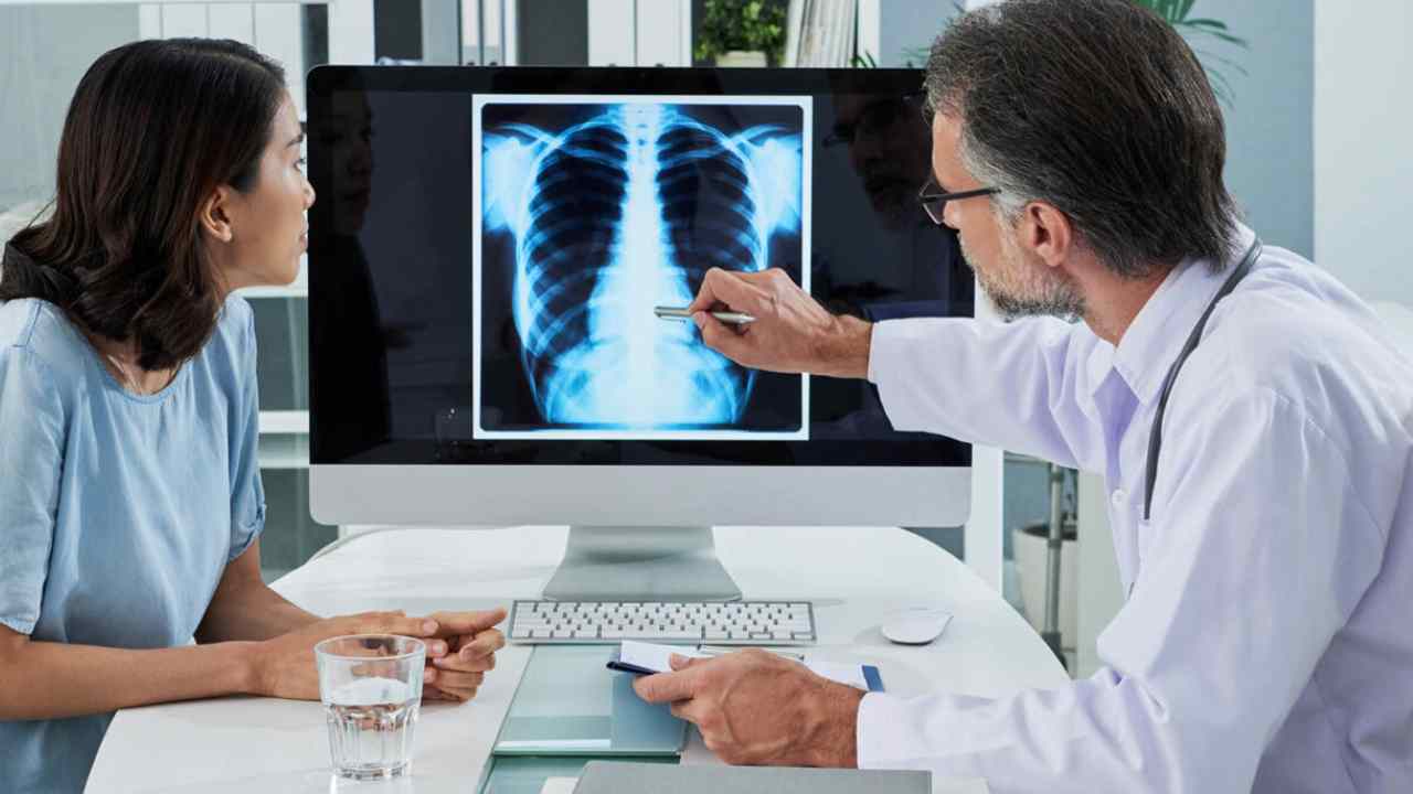 Ilustrasi Kanker Paru Paru. Foto: dok. .health365.id