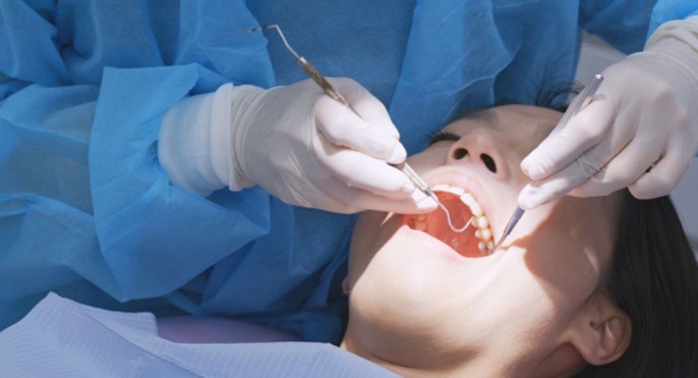 Scaling Gigi. Sumber : alodokter.com